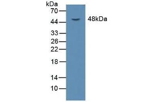Detection of LOX1 in Mouse Liver Tissue using Polyclonal Antibody to Lectin Like Oxidized Low Density Lipoprotein Receptor 1 (LOX1) (OLR1 抗体  (AA 51-314))