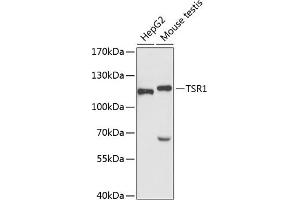 Western blot analysis of extracts of various cell lines, using TSR1 antibody (ABIN6132976, ABIN6149654, ABIN6149655 and ABIN6220781) at 1:3000 dilution. (TSR1 抗体  (AA 455-804))