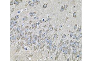 Immunohistochemistry of paraffin-embedded Mouse brain using PRKAB2 Polyclonal Antibody at dilution of 1:100 (40x lens). (PRKAB2 抗体)