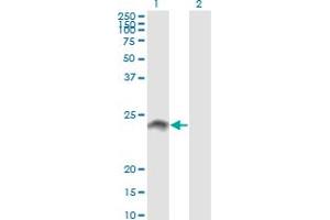 Western Blot analysis of WISP2 expression in transfected 293T cell line by WISP2 monoclonal antibody (M09), clone 3D10. (WISP2 抗体  (AA 24-250))