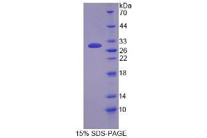 SDS-PAGE analysis of Mouse Docking Protein 3 Protein. (DOK3 蛋白)