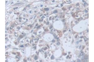 Immunohistochemistry (IHC) image for anti-Retinoic Acid Receptor, alpha (RARA) (AA 68-173) antibody (ABIN7432958)