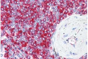 Human Spleen: Formalin-Fixed, Paraffin-Embedded (FFPE)