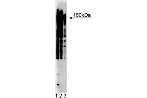 Western blot analysis of phosphotyrosine on A431 cell lysate. (Phosphotyrosine 抗体)