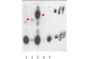 Image no. 1 for anti-Thyroid Hormone Receptor, beta (THRB) (Isoform 1), (Isoform beta-1), (N-Term) antibody (ABIN401449) (THRB 抗体  (Isoform 1, Isoform beta-1, N-Term))