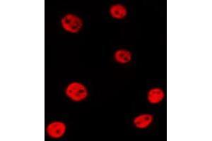 ABIN6279892 staining 293T by IF/ICC. (USP16 抗体  (N-Term))