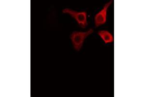 ABIN6267595 staining HuvEc cells by IF/ICC. (Caveolin-1 抗体  (pTyr14))