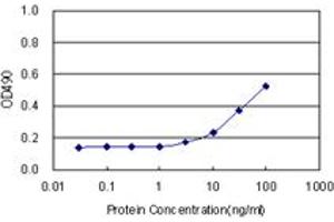 SERPINA6 (Human) Matched Antibody Pair