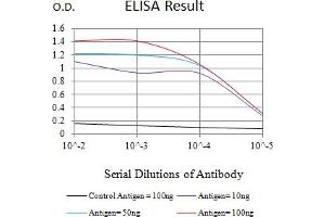Black line: Control Antigen (100 ng),Purple line: Antigen (10 ng), Blue line: Antigen (50 ng), Red line:Antigen (100 ng)