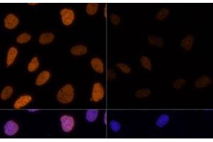 Immunofluorescence analysis of U-2 OS cells using Acetyl-Histone H3-K9/K14/K18/K23/K27 Polyclonal Antibody at dilution of 1:100. (Histone 3 抗体  (acLys9, acLys14, acLys18, acLys23, acLys27))