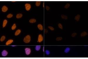 Immunofluorescence (IF) image for anti-Histone 3 (H3) (acLys14), (acLys18), (acLys23), (acLys27), (acLys9) antibody (ABIN7259751)