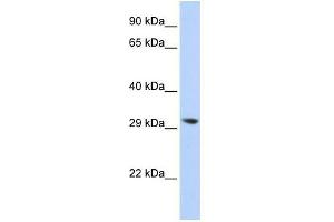 Image no. 1 for anti-Lysophospholipase II (LYPLA2) (N-Term) antibody (ABIN632189) (LYPLA2 抗体  (N-Term))