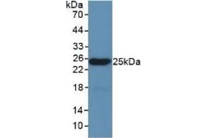 Detection of Recombinant LEP, Mouse using Polyclonal Antibody to Leptin (LEP) (Leptin 抗体  (AA 22-167))