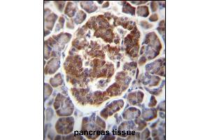 TBC1D22A Antibody (C-term) (ABIN656780 and ABIN2845998) immunohistochemistry analysis in formalin fixed and paraffin embedded human pancreas tissue followed by peroxidase conjugation of the secondary antibody and DAB staining. (TBC1D22A 抗体  (C-Term))