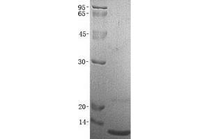 Validation with Western Blot (CCL27 蛋白)