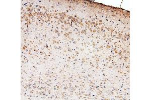 IHC analysis of GLI2 using anti-GLI2 antibody (ABIN6719569). (GLI2 抗体  (AA 721-1457))