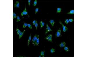 IF analysis of IL2 Receptor beta/p75/IL2RB using anti- IL2 Receptor beta/p75/IL2RB antibody (ABIN7600988). (IL2 Receptor beta 抗体  (AA 268-551))