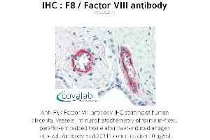 Image no. 2 for anti-Coagulation Factor VIII (F8) antibody (ABIN1723234) (Factor VIII 抗体)
