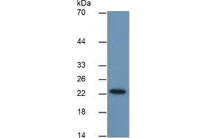 Mouse Capture antibody from the kit in WB with Positive Control: Sample Human MCF7 cell lysate. (GSTP1 ELISA 试剂盒)
