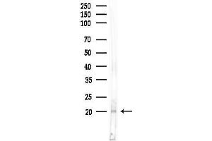 anti-Adenine Phosphoribosyltransferase (APRT) (Internal Region) antibody
