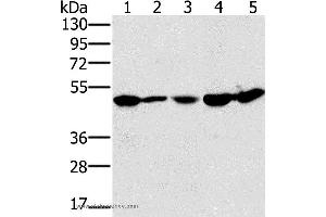 Western blot analysis of 231 and Jurkat cell, mouse liver tissue, 293T and hela cell, using PSMC2 Polyclonal Antibody at dilution of 1:400 (PSMC2 抗体)