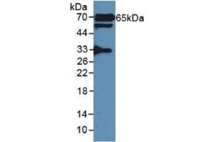 Detection of GAD2 in Rat Serum using Polyclonal Antibody to Glutamate Decarboxylase 2 (GAD2) (GAD65 抗体  (AA 188-374))