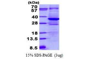 Tetratricopeptide Repeat Domain 33 (TTC33) (AA 1-262) protein (His tag)