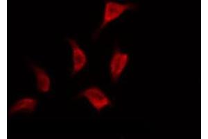 ABIN6267355 staining HepG2 by IF/ICC.