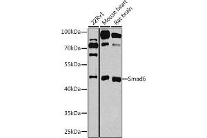 Western blot analysis of extracts of various cell lines, using Smad6 antibody (ABIN3015229, ABIN3015230, ABIN3015231 and ABIN6213893) at 1:1000 dilution. (SMAD6 抗体  (AA 257-496))