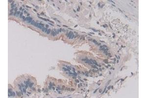 Immunohistochemistry (IHC) image for anti-Annexin A11 (ANXA11) (AA 1-505) antibody (ABIN7435868)