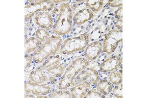 Immunohistochemistry of paraffin-embedded rat kidney using RNF166 antibody (ABIN5974659) (40x lens). (RNF166 抗体)