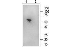Western blotting of rat kidney membranes: - 1.