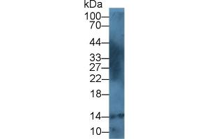 Detection of S100A12 in Human Leukocyte lysate using Polyclonal Antibody to S100 Calcium Binding Protein A12 (S100A12) (S100A12 抗体  (AA 2-92))