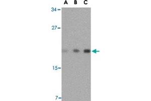 Western blot analysis of TMED10 in mouse brain tissue lysate with TMED10 polyclonal antibody  at (A) 0. (TMED10 抗体  (Internal Region))