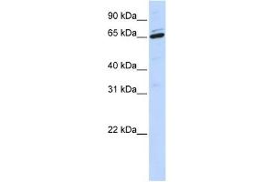 ARSH antibody used at 1 ug/ml to detect target protein. (Arylsulfatase H 抗体  (Middle Region))