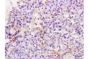 Formalin-fixed and paraffin embedded rat pancreas tissue labeled with Anti-MTUS1 Polyclonal Antibody, Unconjugated  at 1:200 followed by conjugation to the secondary antibody and DAB staining (MTUS1 抗体  (AA 1151-1270))