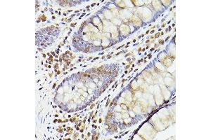 Immunohistochemistry (IHC) image for anti-Tet Methylcytosine Dioxygenase 2 (TET2) (AA 1833-2002) antibody (ABIN1513598)