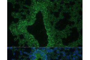 Immunofluorescence analysis of Mouse lung cells using IL25 Polyclonal Antibody at dilution of 1:100. (IL-25 抗体)