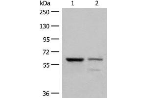 Western blot analysis of Human left kidney cancer tissue and HEPG2 cell lysates using HNF1A Polyclonal Antibody at dilution of 1:200 (HNF1A 抗体)
