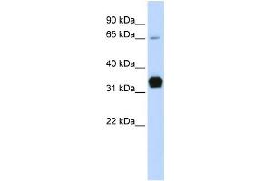 WB Suggested Anti-TNNT1 Antibody Titration:  0. (TNNT1 抗体  (Middle Region))