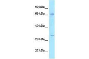 Image no. 1 for anti-Hydroxysteroid (17-Beta) Dehydrogenase 3 (HSD17B3) (AA 51-100) antibody (ABIN6747984) (HSD17B3 抗体  (AA 51-100))