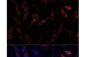 Immunofluorescence analysis of C6 cells using VPS25 Polyclonal Antibody at dilution of 1:100 (40x lens). (VPS25 抗体)