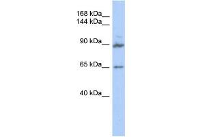 WB Suggested Anti-GPRASP2 Antibody Titration: 0. (GPRASP2 抗体  (Middle Region))