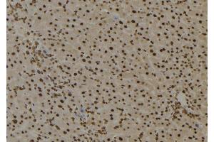 ABIN6276735 at 1/100 staining Mouse liver tissue by IHC-P. (BTK 抗体  (Internal Region))