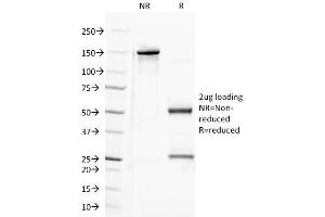 SDS-PAGE Analysis Purified CD100 Mouse Monoclonal Antibody (A8). (SEMA4D/CD100 抗体)