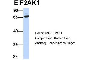 Host:  Rabbit  Target Name:  EIF2AK1  Sample Type:  Human Hela  Antibody Dilution:  1.