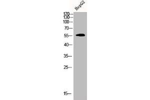 Western Blot analysis of HEPG2 cells using CDYL2 Polyclonal Antibody (CDYL2 抗体  (N-Term))