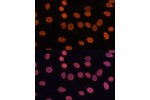 Immunofluorescence analysis of C6 cells using T antibody (ABIN7270900) at dilution of 1:100. (TADA3L 抗体  (AA 270-369))