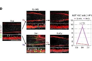 Immunofluorescence (Paraffin-embedded Sections) (IF (p)) image for anti-Keratin 14 (KRT14) antibody (ABIN2855778)