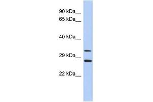 WB Suggested Anti-BIRC7 Antibody Titration:  0. (BIRC7 抗体  (Middle Region))